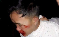 Thanh niên đi xe máy vào tận thôn quê giật dây chuyền vàng