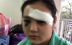 Vụ cắt tai thiếu nữ: Do mâu thuẫn chứ không phải vì làm chứng
