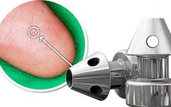 Stent siêu nhỏ 'kết liễu' bệnh tăng nhãn áp