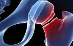 Cận cảnh nối xương bị gãy