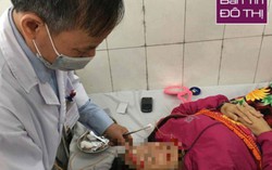Nhập viện vì méo mồm, liệt mặt, viêm đường hô hấp do lạnh kéo dài