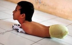 Cậu bé không chân tay sống đầy nghị lực
