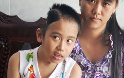 Bé trai bị liệt não vì tai nạn