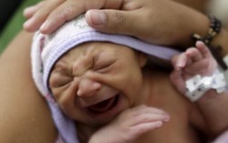 Chuyên gia bày cách phòng dị tật đầu nhỏ ở trẻ do Zika