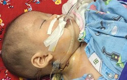 Bé 5 tháng tuổi co giật bởi ngộ độc chì vì bố mẹ cho dùng thuốc cam