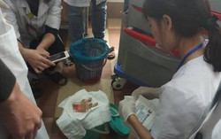 Nghệ An: Chủ quán ăn bị cha con ông lão xe ôm chém đứt lìa bàn tay