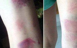 Lãnh đạo Sở GD&ĐT Bà Rịa - Vũng Tàu xin lỗi các học sinh bị cô giáo đánh