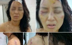 Bạo lực không bị tố cáo, cái ác sẽ nhân lên