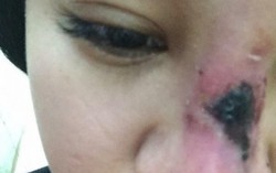 Vụ phẫu thuật hỏng mũi: "Bác sĩ "17 tuổi chưa học xong cấp 3