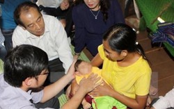 Virus gây tật đầu nhỏ sẽ lưu hành như bệnh sốt xuất huyết