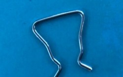 Gắp dị vật sắc nhọn trong đường tiêu hóa bé trai 18 tháng tuổi