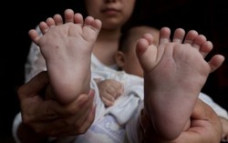 Cha cậu bé 31 ngón dừng quyên góp, tự kiếm tiền phẫu thuật cho con