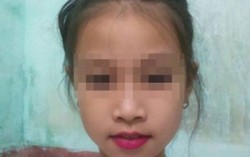 Bé gái bị bạn phi bút hỏng mắt, liệu cô giáo có thờ ơ?