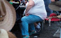 4% số ca ung thư trên toàn thế giới có nguyên nhân từ béo phì