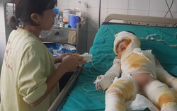 Vụ 3 trẻ mầm non bị bỏng nặng: Đình chỉ hoạt động nhóm trẻ tư thục Tuổi Thơ