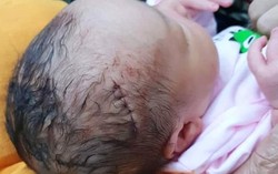 Bà nội bàng hoàng khi đón cháu trai sơ sinh từ phòng mổ với 6 mũi khâu trên đầu