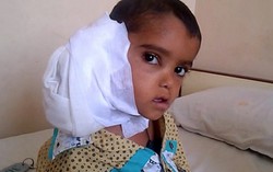 Cậu bé ung thư di căn vì bác sĩ tìm mãi không ra bệnh 
