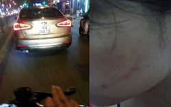 Tài xế tát phụ nữ giữa phố được công an mời lên làm rõ