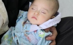 Nội soi cứu bệnh nhi xoắn cuống lách hiếm gặp