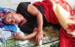 Nghệ An: Đi làm ruộng, một người dân bị lợn rừng cắn đứt ngon tay
