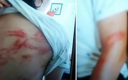 Vụ bố bị tố bạo hành dã man con đẻ: Nỗi đau xót của người mẹ