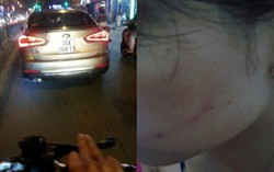 Cô gái bị bạt tai giữa phố đúng ngày 'xóa bỏ bạo lực với phụ nữ'