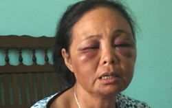 2 phụ nữ bị đánh vì nghi bắt cóc trẻ em là người hiền lành, nhân hậu