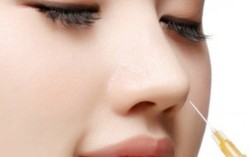 Mẹ yêu cầu con trai bỏ người yêu khi biết cô đã đi thẩm mỹ