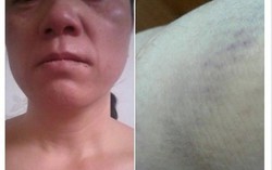 Đền bù hợp đồng, sớm đưa nữ lao động về nước