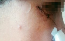 Con rể dùng điếu cày, dao tấn công mẹ vợ và vợ