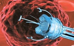 Loại bỏ khối u không cần phẫu thuật bằng robot nano