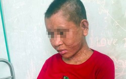 Sẵn sàng phẫu thuật thẩm mỹ miễn phí cho cô gái giúp việc bị chủ bạo hành 