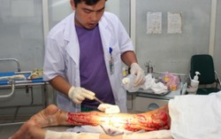 Hoại tử chân do tiêm thuốc không rõ nguồn gốc