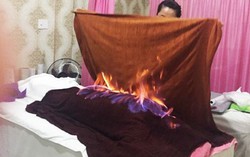 Dùng hỏa trị liệu làm đẹp coi chừng bị bỏng, rối loạn khí huyết