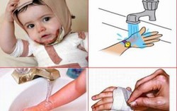 Bé 2 tháng tuổi bỏng khi tắm