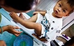 Hỗ trợ 12.000 trẻ cải thiện suy dinh dưỡng và thấp còi