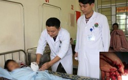 Mất ngón tay vì 'đùa' với pháo tự chế