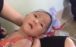 Bé gái 14 tháng, nặng 3,5kg được phục hồi chức năng