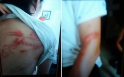 Hà Nội: Bà ngoại tố bố đẻ bạo hành dã man 2 cháu nhỏ