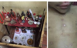 Cậu bé Brazil bị tra tấn mù mắt vì phải làm vật tế cho nghi lễ đen tối