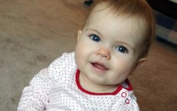 Sự hồi sinh kỳ diệu của cô bé ruột để ngoài da