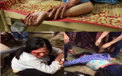 Hội chứng “bắt cóc trẻ em” và những người manh động