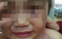 Bắt được người tình của mẹ bạo hành bé 3 tuổi