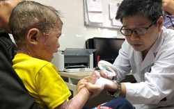 Xót xa bé 5 tuổi bị bong tróc da toàn thân, bố mẹ không có tiền cho con chữa bệnh