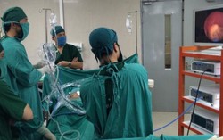 Tán sỏi thận lớn 2cm qua da không gây đau đớn