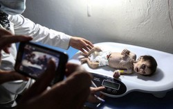 Quặn thắt hình ảnh những đứa trẻ Syria chỉ còn da bọc xương