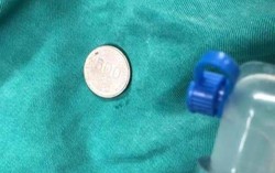 Bé 3 tuổi khóc thét vì nuốt đồng xu vào miệng