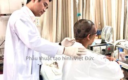 Tóc quấn vào máy, nữ công nhân bị lột toàn bộ da vùng đầu và nửa mặt