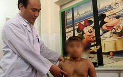 Số bé trai bị lõm ngực nhiều gấp đôi bé gái