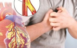 Báo động bệnh tật vì người Việt lười vận động, ăn ít rau quả